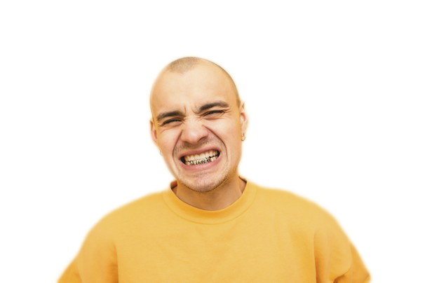 expressive-young-man-with-grillz-his-teeth-is-angry-with-yellow_245974-3182 White Gold Joker Style Grillz