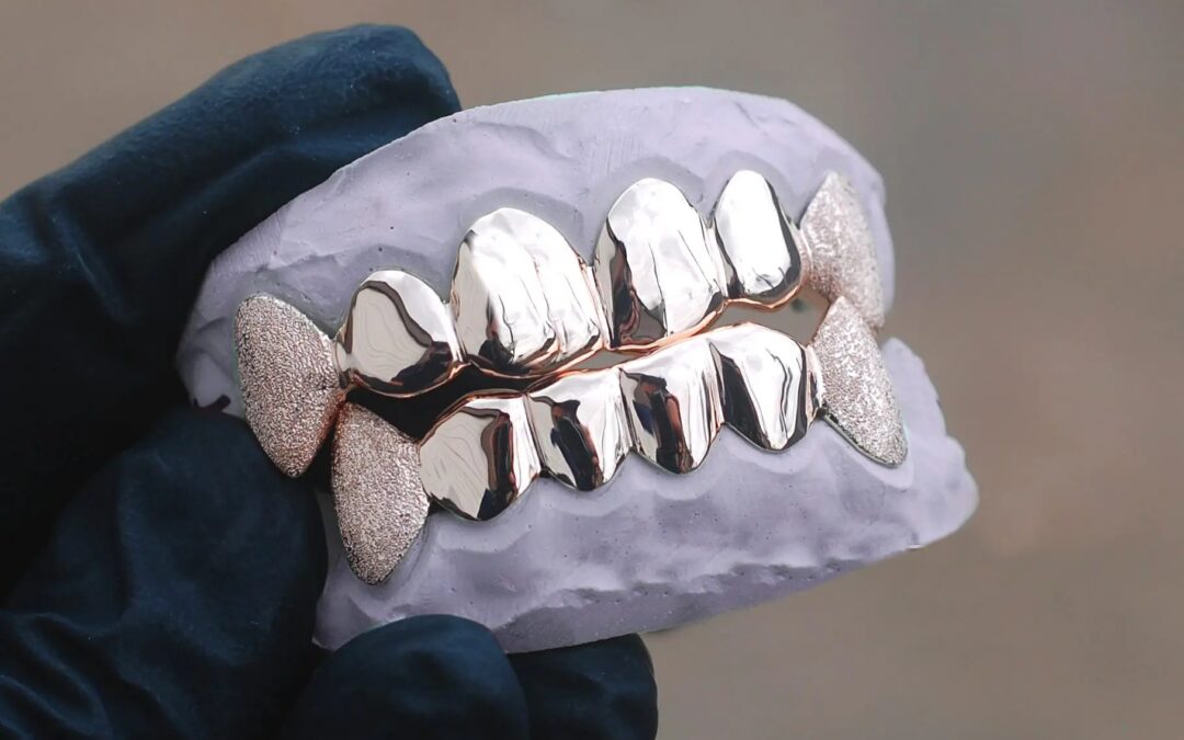 Where Can You Get The Best Gold Grillz in Houston? GotGrillz Has The Finest Collection