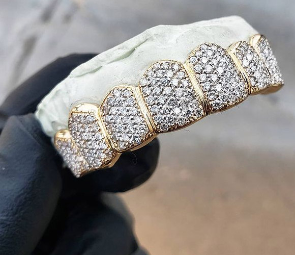 Custom Diamond Grillz in Houston