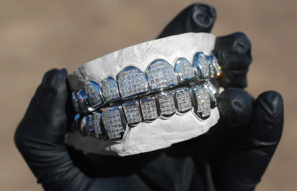 White Gold Grillz Houston