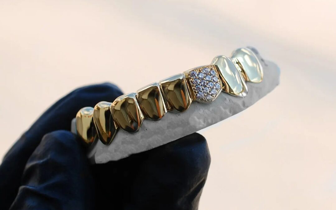 Yellow Gold Grillz Houston