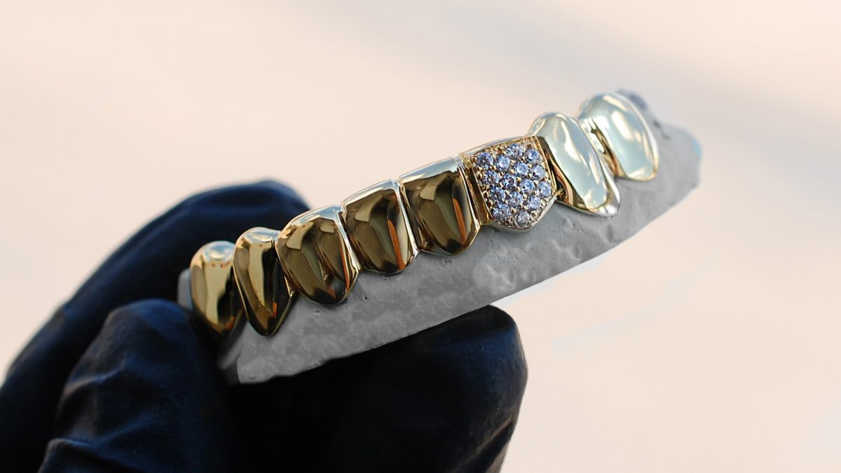 GotGrillz - Online Teeth Jewelry Shop - Custom Gold Teeth Grillz