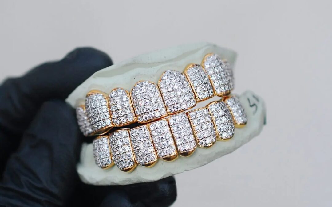 Get Highest Quality Custom Diamond Grillz in Houston At GotGrillz