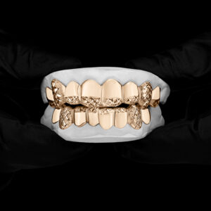 Yellow Gold Diamond Dust Cut Tip and Full K9 Top and Bottom Grillz