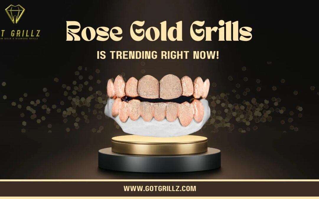 Rose Gold Grills in Houston - GotGrillz