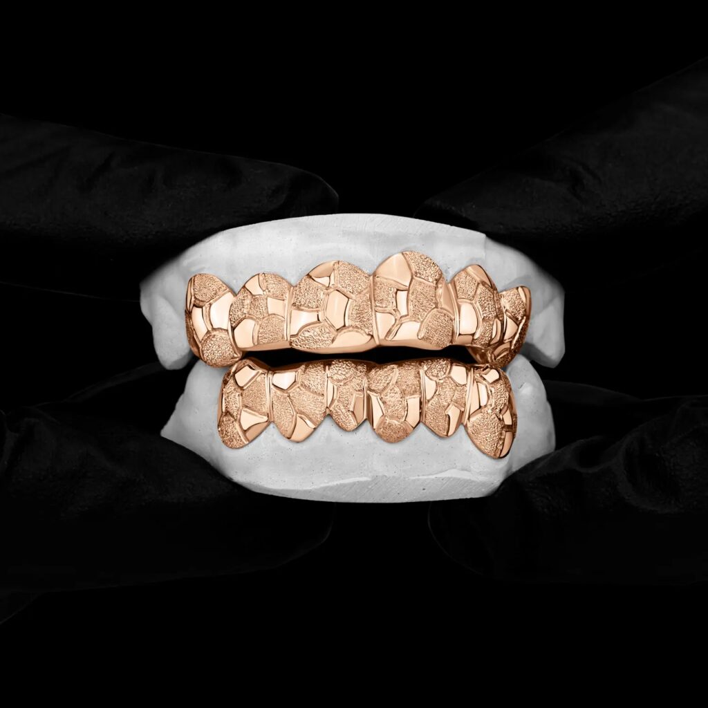 Rose Gold Nugget Grillz