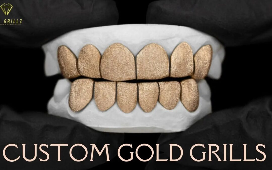 Custom Gold Grills Houston - GotGrillz