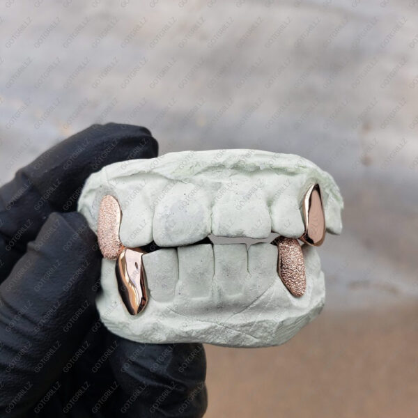 Rose Gold Diamond Dust and Polished K9 Grillz - GotGrillz