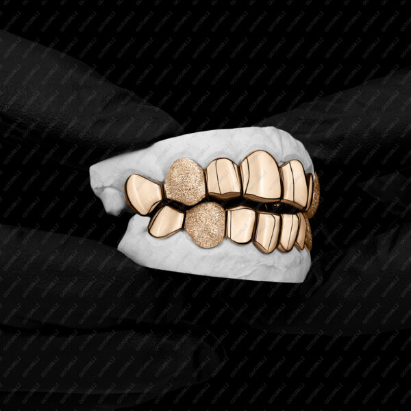 Yellow Gold K9 Fangs Diamond Dust Grillz - GotGrillz