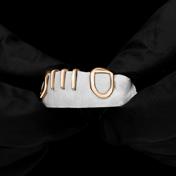 Rose Gold Multi Gap Bar with Open Face K9 Grillz - GotGrillz