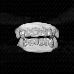 White Gold Nugget Cut Style Grillz - GotGrillz