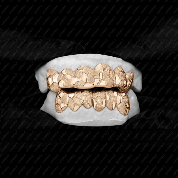 Yellow Gold Nugget Cut Grillz - GotGrillz