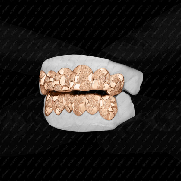 Rose Gold Nugget Grillz - GotGrillz