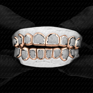 Rose Gold Diamond Dust Punchout Grillz - GotGrillz