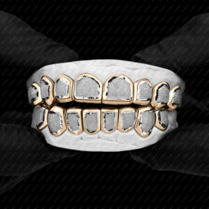 Yellow and White Gold Diamond Dust Punchout Grillz - GotGrillz