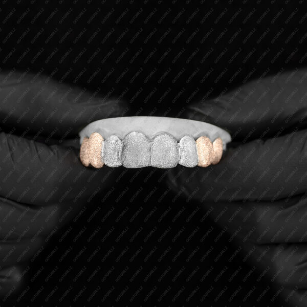 Yellow and White Full Diamond Dust Grillz - GotGrillz