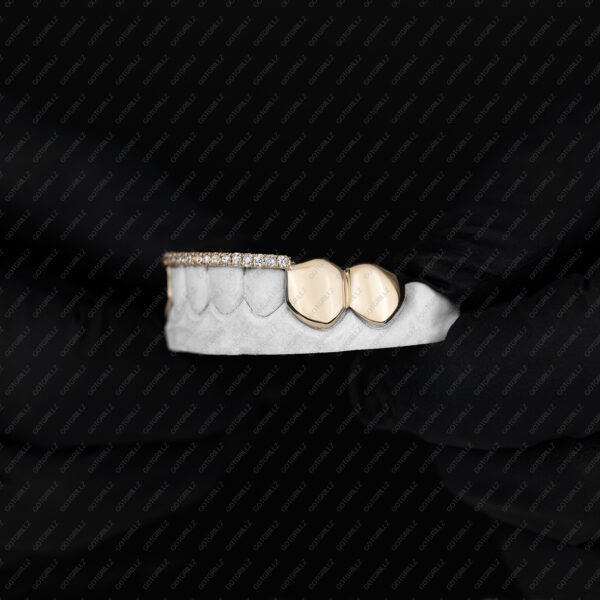 Gold Diamond Top Bar Grillz - GotGrillz