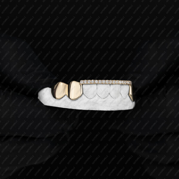 Gold Diamond Top Bar Grillz - GotGrillz