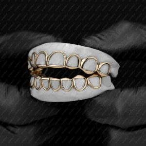 Yellow Gold Classic Solid Open Face Grillz - GotGrillz