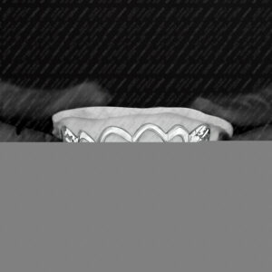 White Gold Diamond Cut Tip Open Outline Grillz - GotGrillz