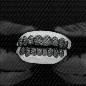 Black Gold Diamond Dust Cut Grillz - GotGrillz