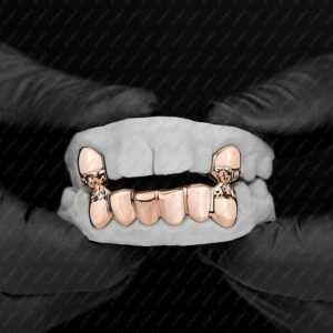 Rose Gold Diamond Cut Tip K9 and Diamond Cut Bottom Grillz - GotGrillz