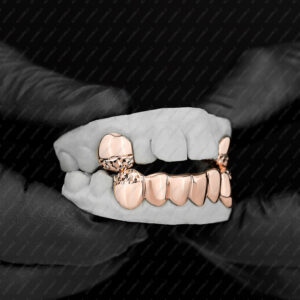 Rose Gold Diamond Cut Tip K9 and Diamond Cut Bottom Grillz - GotGrillz