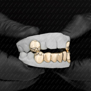 Yellow Gold Diamond Cut Tip K9 and Diamond Cut Bottom Grillz - GotGrillz