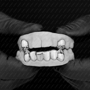 White Gold Diamond Cut Tip K9 and Diamond Cut Bottom Grillz - GotGrillz