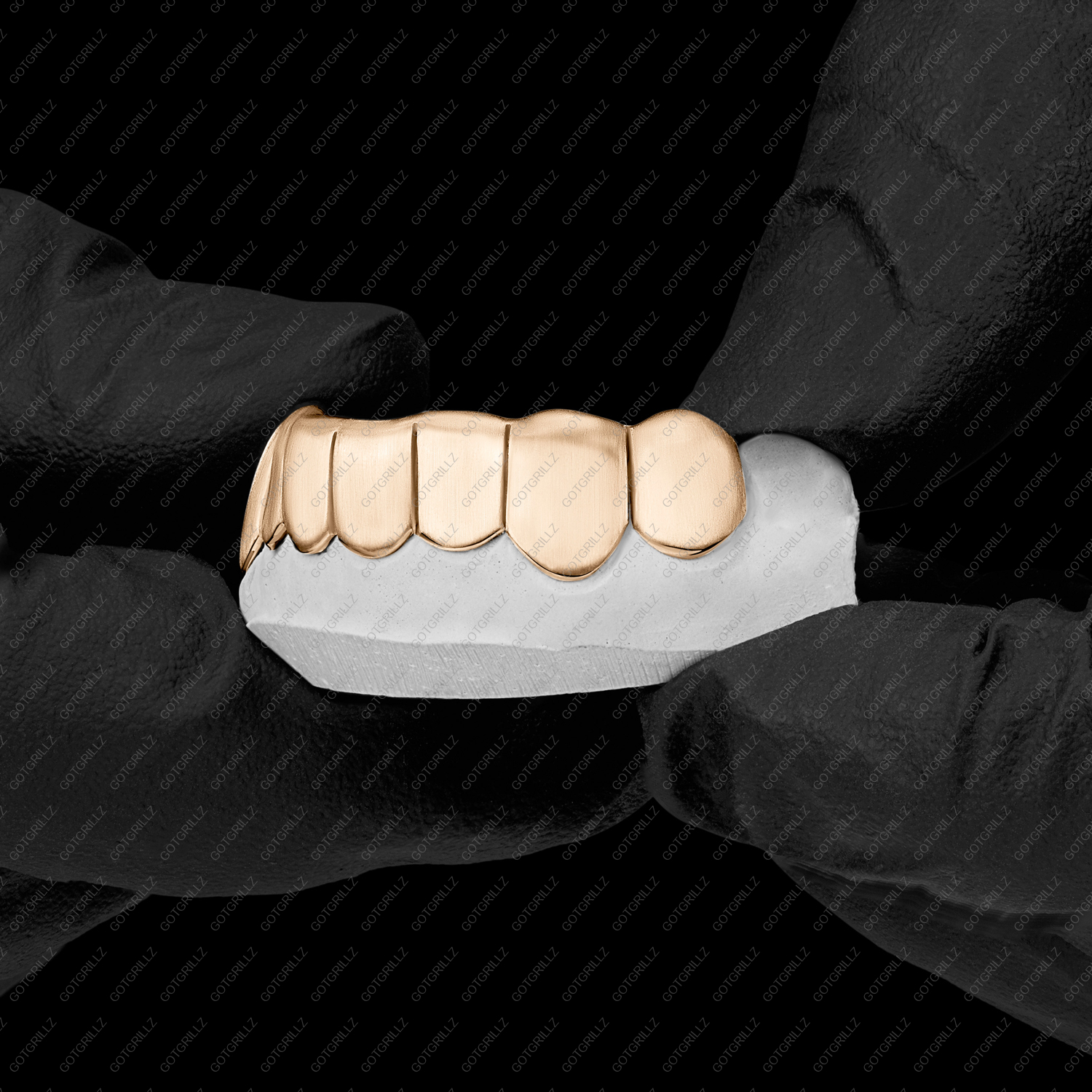 Gold Teeth Molding Kit 