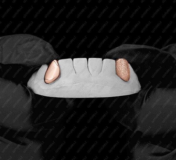 Rose Gold Diamond Dust and Polished K9 Grillz - GotGrillz