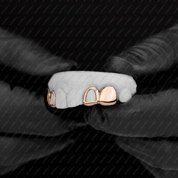 Rose Gold Double Cap Solid K9 Open Face Grillz - GotGrillz