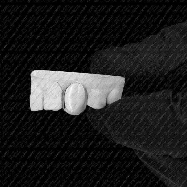 White Gold Single Tooth Grillz - GotGrillz