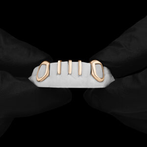 Yellow Gold Multi Gap Bar with Open Face K9 Grillz - GotGrillz