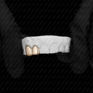 Yellow Gold Double Cap Grillz - GotGrillz