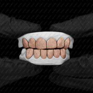 Rose Gold Full Diamond Dust Grillz - GotGrillz