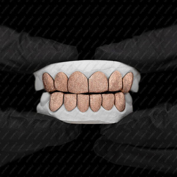 Rose Gold Full Diamond Dust Grillz - GotGrillz