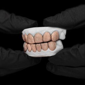 Rose Gold Full Diamond Dust Grillz - GotGrillz