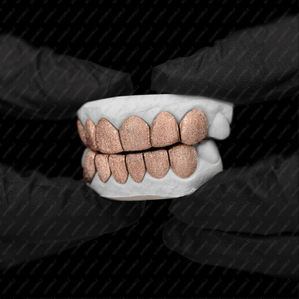 Rose Gold Full Diamond Dust Grillz - GotGrillz