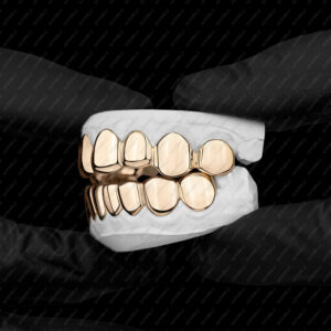 Yellow Gold Polished Solid Classic Grillz - GotGrillz