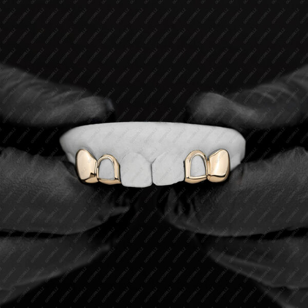 Yellow Gold Double Cap Solid K9 Open Face Grillz - GotGrillz
