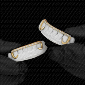 Yellow Gold J Hook Style Iced Diamond Bar Bottom Kim K Grillz - GotGrillz