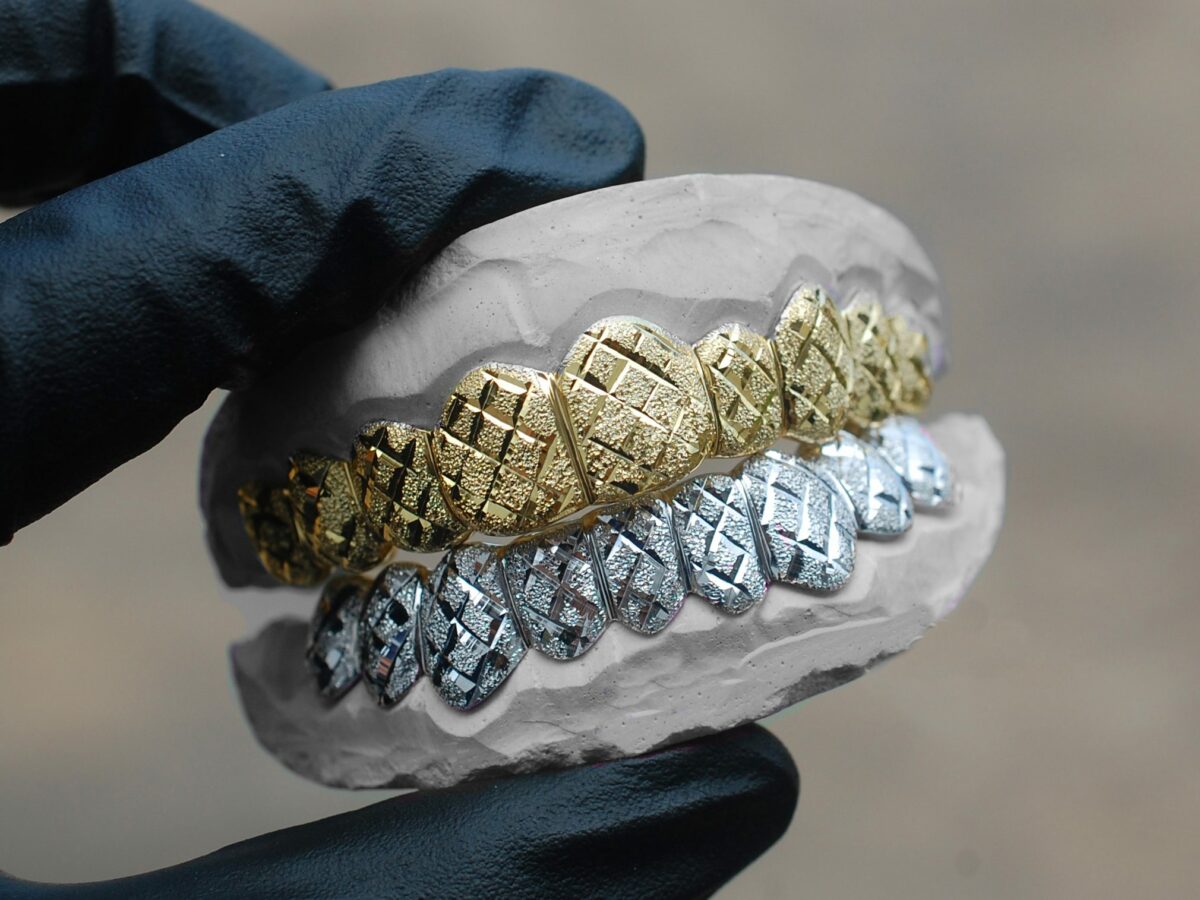 Yellow and White Gold Diamond Dust Cut Grillz