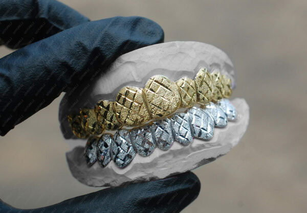 Yellow and White Gold Diamond Dust Cut Grillz - GotGrillz