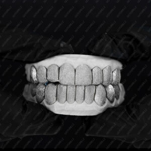 White Gold Full Diamond Dust Grillz - GotGrillz