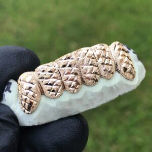 Yellow Gold Full Diamond Dust Cut Grillz - GotGrillz