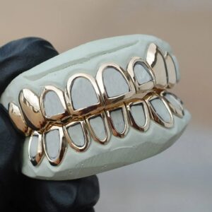 Yellow Gold Classic Open Face Solid K9 Gold Grillz - GotGrillz
