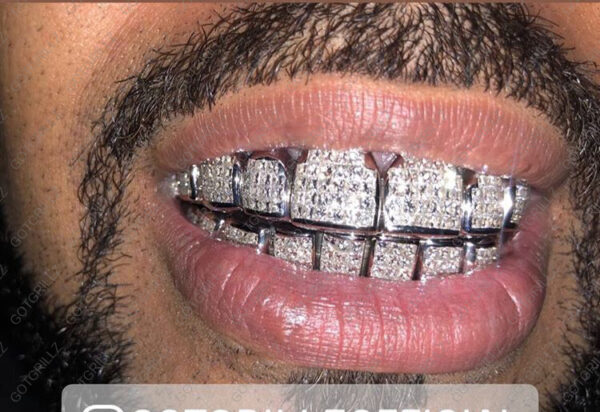 White Gold Invisible Set Cut Grillz