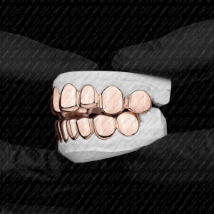 Rose Gold Polished Solid Classic Grillz - GotGrillz