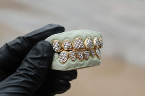 Yellow and White Gold Diamond Dust Cut Punchout Grillz - GotGrillz